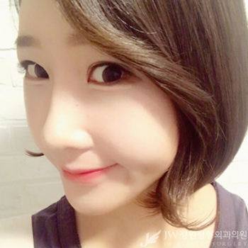 JW정원성형외과 눈+코성형으로 단아한 이미지 완성♡ 관련 이미지 1