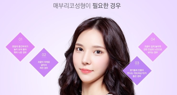 매부리코 교정 A to Z, JW정원성형외과 매부리코 교정 관련 이미지 4