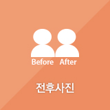 JW정원성형외과 큐어스킨으로 자연스럽고 오래오래 동안효과!! 관련 이미지 4