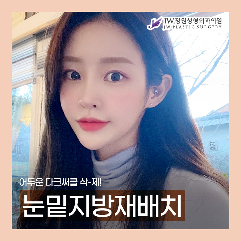 눈밑지방재배치잘하는곳 발생 원인을 파악하고 관련 이미지 1
