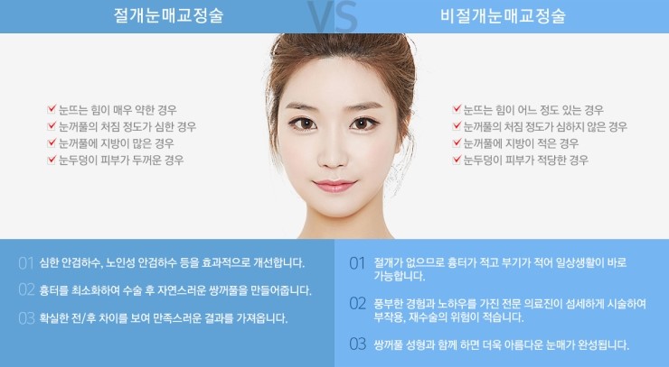 졸려 보이는 눈, 답답한 눈매 JW정원성형외과 눈매교정술로! 관련 이미지 3