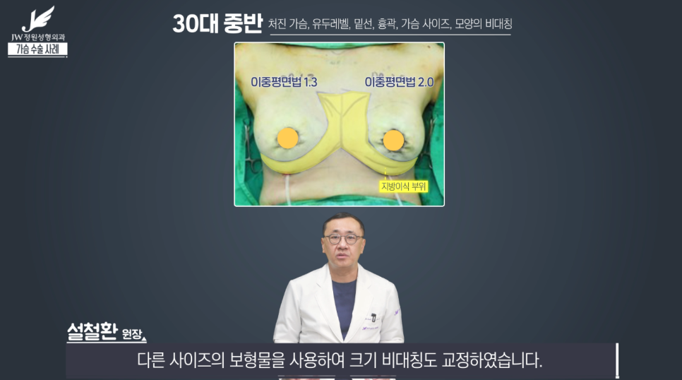 처진가슴교정 치밀한 계획으로 완성도는 UP! 【강남 JW정원성형외과】 관련 이미지 12