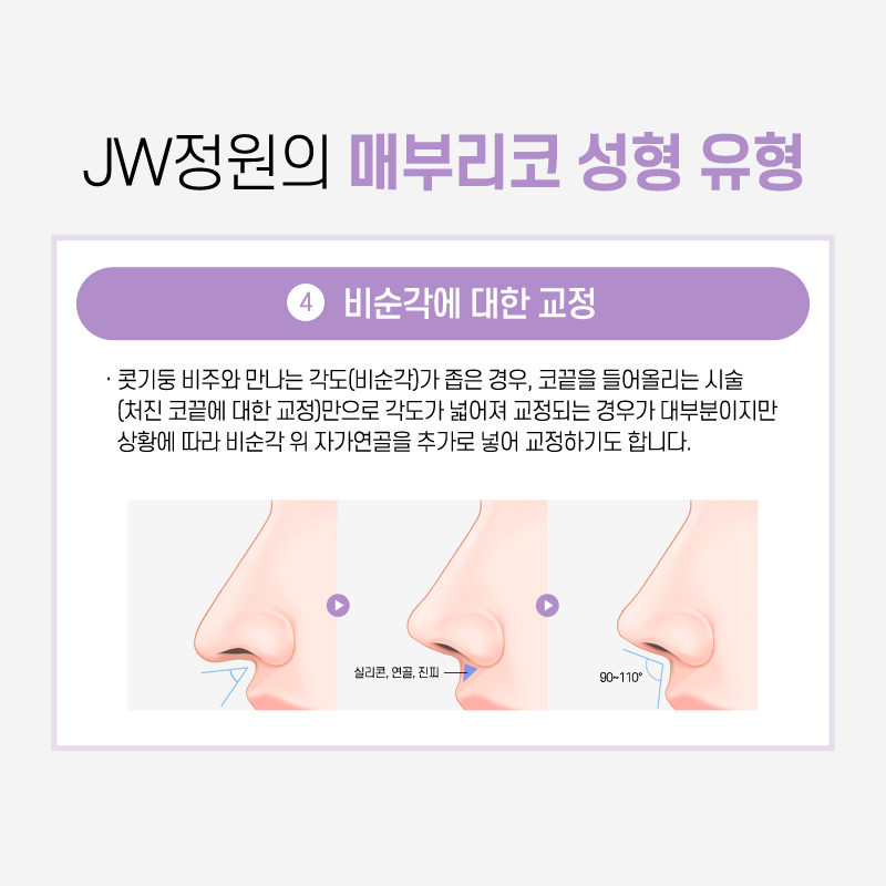 Hump Nose Surgery Cost: If You Want a Softer Line image 8