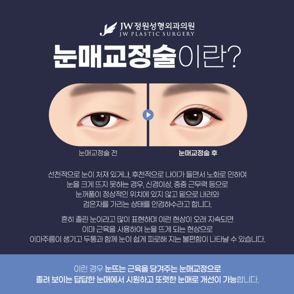 An Eye Correction Clinic to Help You Move Beyond a Dull Impression image 2