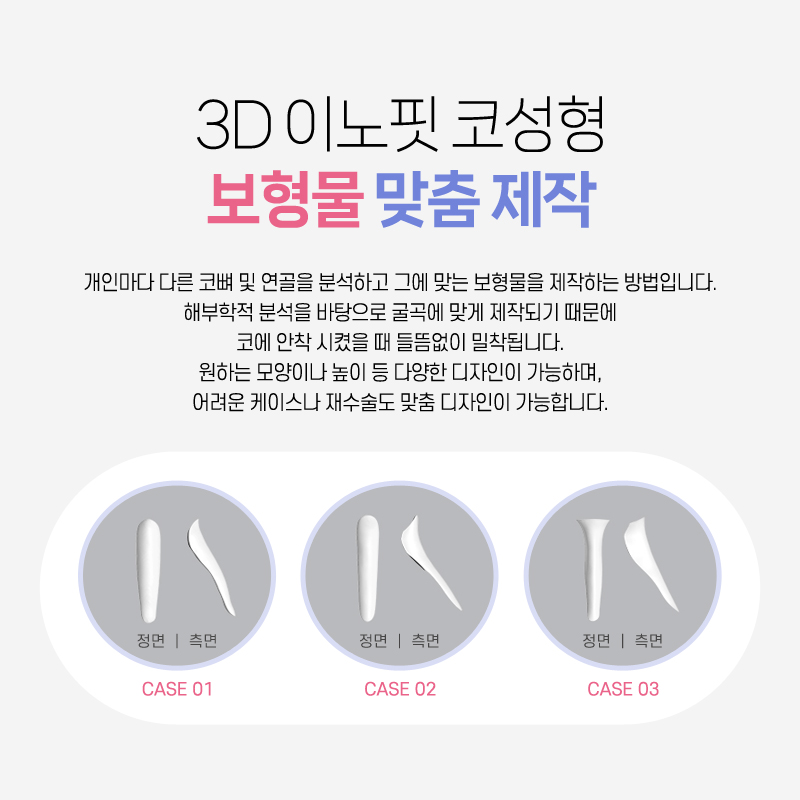 코수술병원 높은 콧대를 바란다면 관련 이미지 3