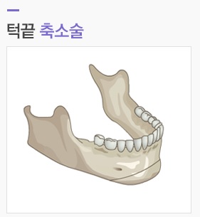 매끈한 얼굴라인과 턱기능 개선을 동시에! JW정원성형외과 주걱턱성형 관련 이미지 2