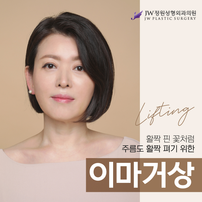 Anti-Aging Endoscopic Forehead Lift with a Thorough Plan image 1