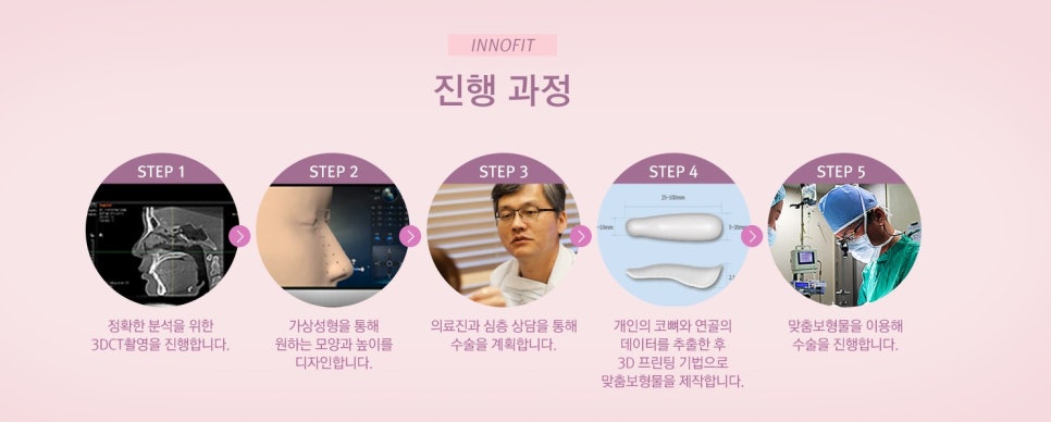 [JW Jeongwon Plastic Surgery] A Perfect Fit for My Nose! 3D-Printed Custom Nasal Implant Rhinoplasty image 5