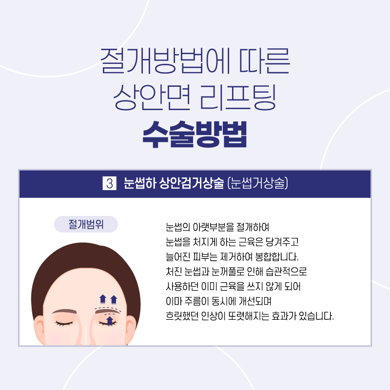 이마거상후기 리프팅으로 쫙 올라간 효과는 관련 이미지 5