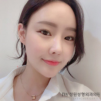 A Deviated Nose, Beautiful Nose Line, and Rhinoplasty with Nasal Obstruction Surgery All at Once! image 1