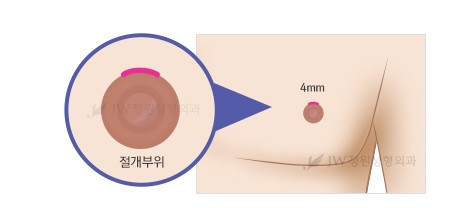 남모를 고민 관련 이미지 4