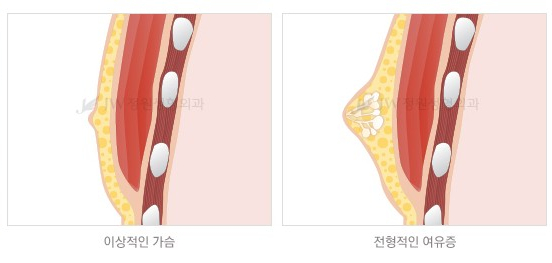 남모를 고민 관련 이미지 2