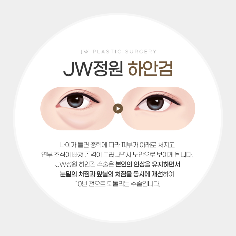 Lower Eyelid Surgery Review: Satisfying Results 【Gangnam JW Garden Plastic Surgery】 image 2