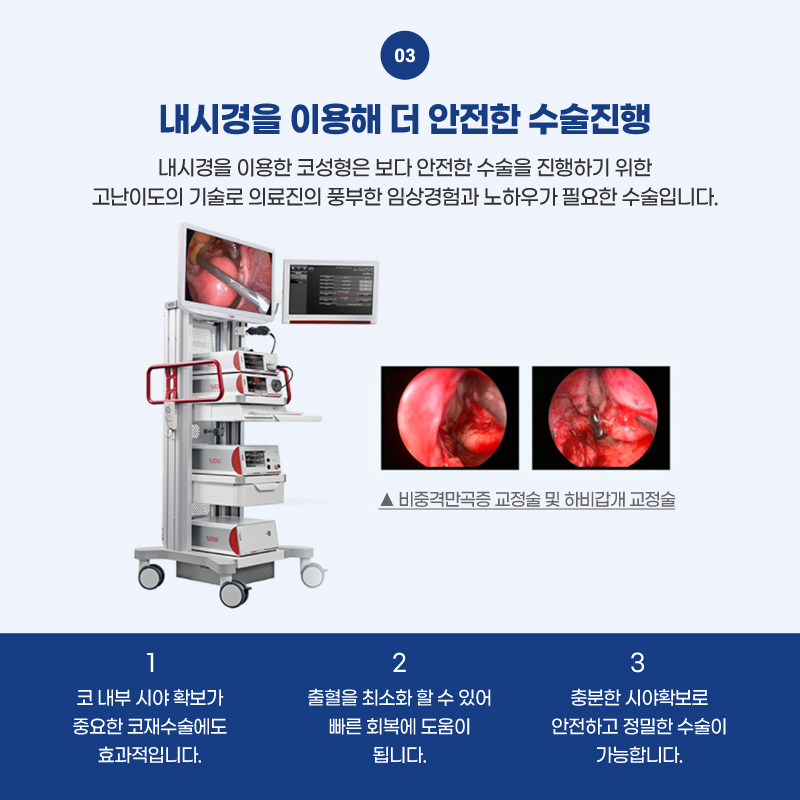 코재수술병원 원인부터 해결할 수 있도록 관련 이미지 5