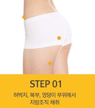 세월의 흔적을 감추는 매끈한 손등! JW정원성형외과 손등지방이식 관련 이미지 2