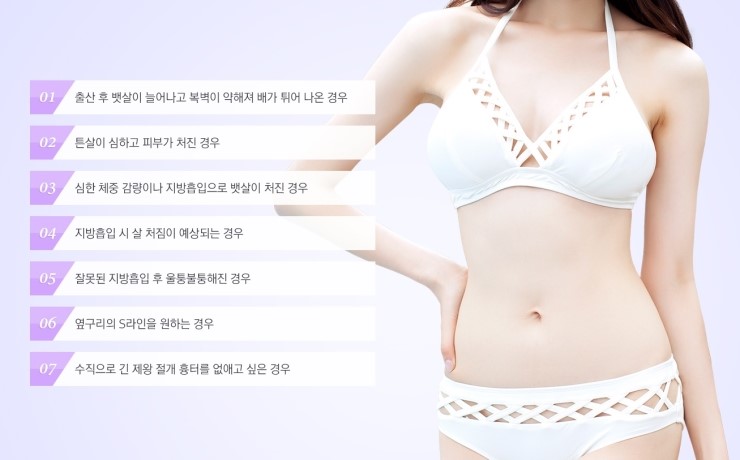 처지고 늘어진 뱃살 탈출! 완벽 S라인으로 변신 JW정원 복부성형 관련 이미지 2