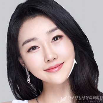 빠르고 간단하게 예뻐지는 노하우! JW정원성형외과 보톡스 관련 이미지 2