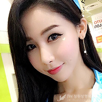 절개 없이 탄력 있는 브이라인! JW정원성형외과 실리프팅으로 관련 이미지 4