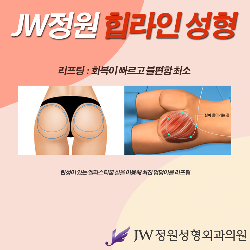 Perfect S-Line, Completed with JW Garden Hip Line Surgery image 7