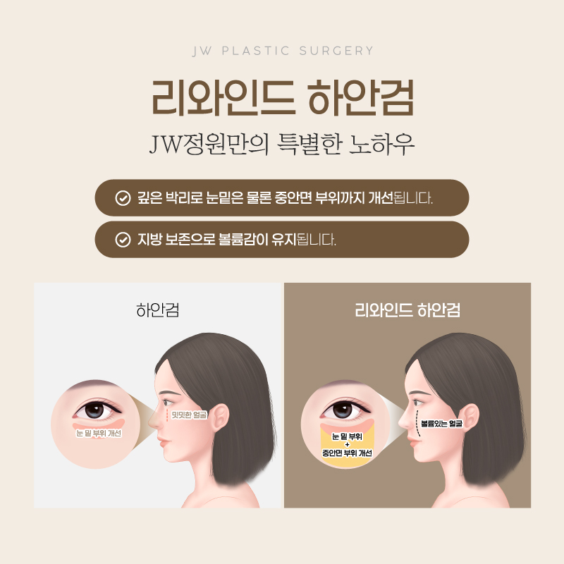 Lower Eyelid Surgery Review: Satisfying Results 【Gangnam JW Garden Plastic Surgery】 image 3
