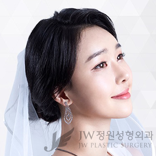 이마눈썹리프팅,눈매교정술,앞트임복원,코성형,지방이식 ⇒ JW정원성형외과에서! 관련 이미지 1