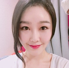 뒤트임 잘하는 병원! JW정원성형외과 뒷트임 성형 관련 이미지 3