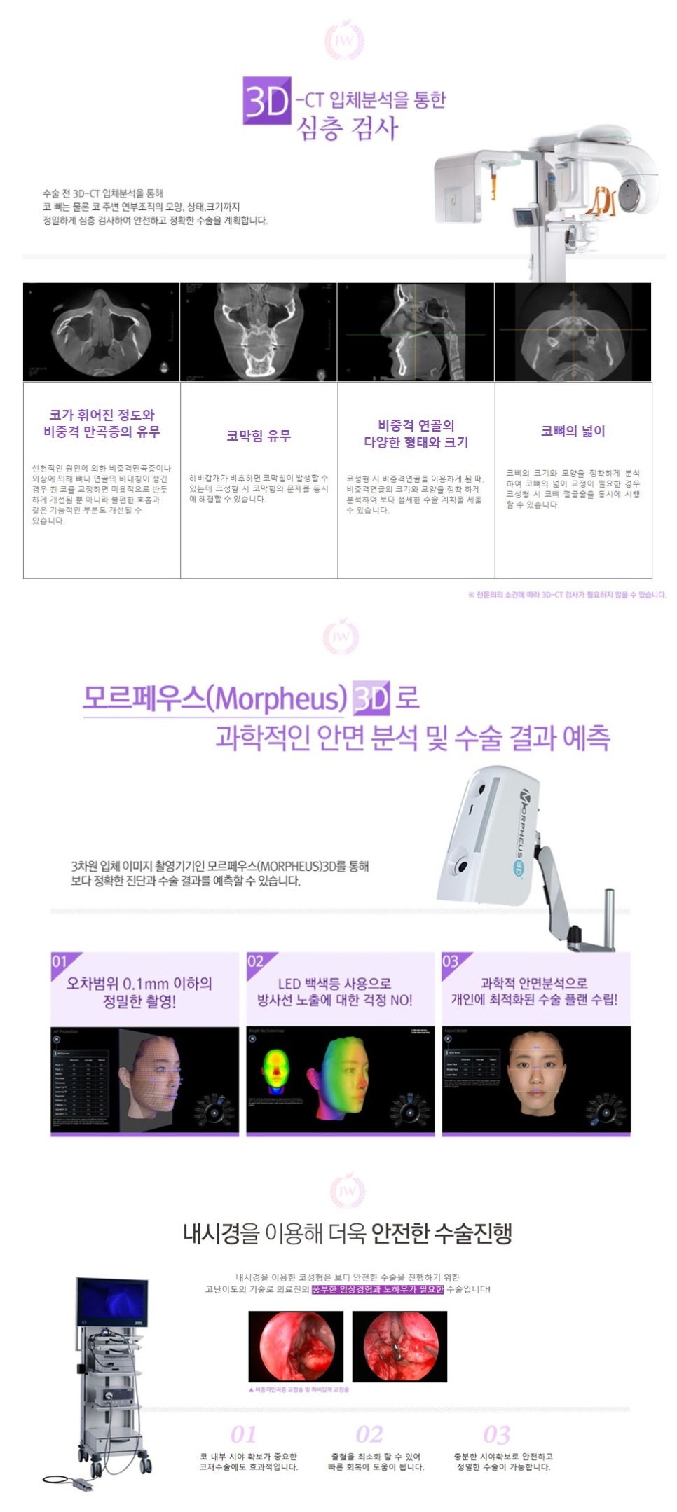 휜코교정 근본적인 미용/기능 개선(코막힘, 비염, 두통 등) 관련 이미지 10