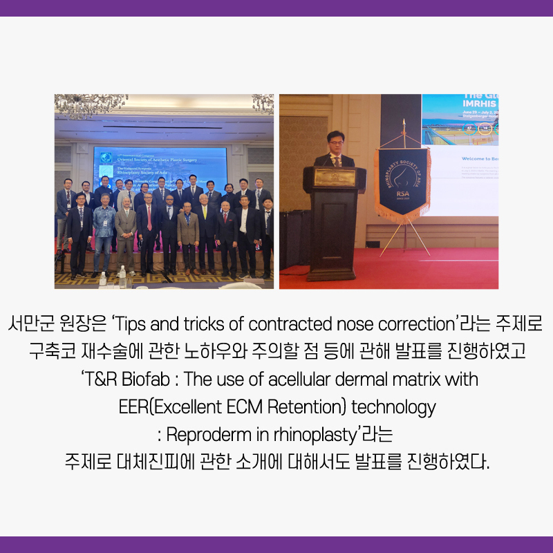 강남 JW정원성형외과 : 서만군, 김연준 원장 OSAPS, RSA 심포지엄 초청 강의 관련 이미지 4