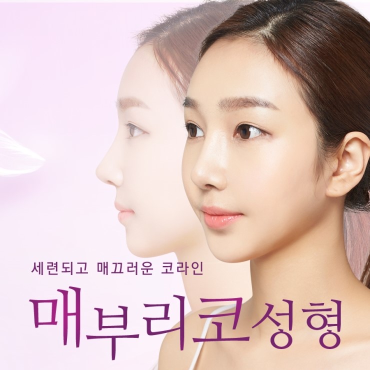 날렵하고 부드러운 이미지로! JW정원성형외과 매부리코성형 관련 이미지 2
