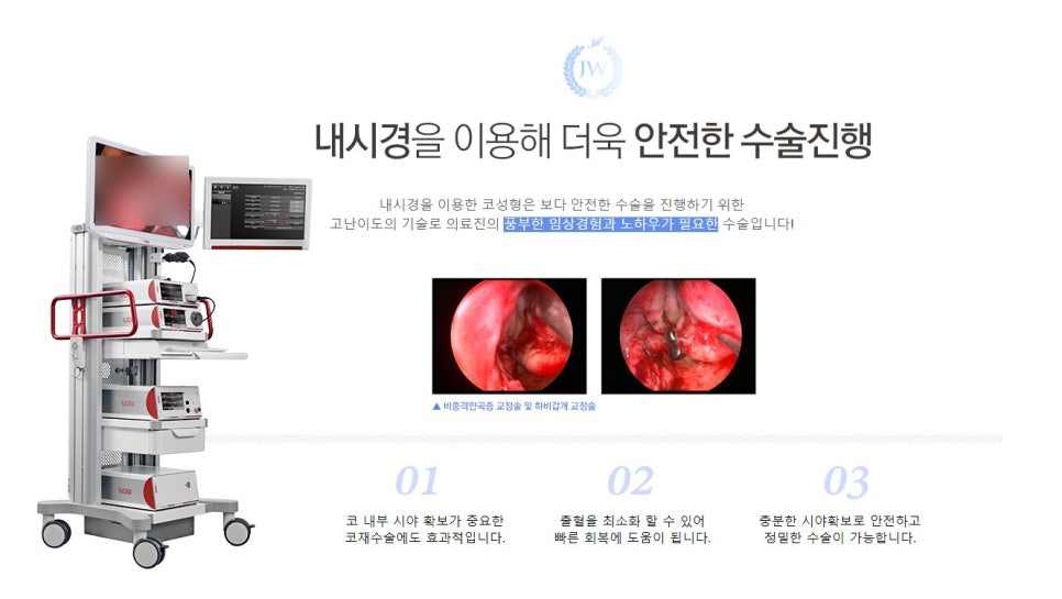 무보형물 복코성형, 콧볼축소수술후 자신감 뿜뿜 관련 이미지 8