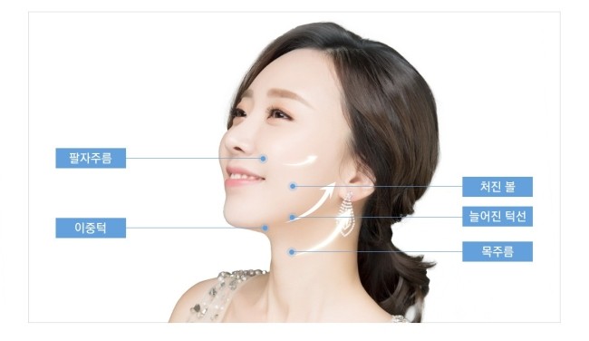 탄성밴드로 완성하는 동안얼굴! JW정원 엘라스티꿈 리프팅 관련 이미지 6