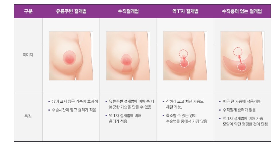 자연스럽고 아름다운 비율, JW정원 가슴축소수술로 관련 이미지 5