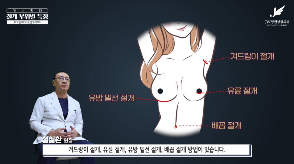 가슴수술흉터 없었던 것처럼 걱정을 덜어주니까! 【강남 JW정원성형외과】 관련 이미지 4