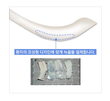 재수술 없는 JW정원성형외과 늑연골 코성형 관련 이미지 6