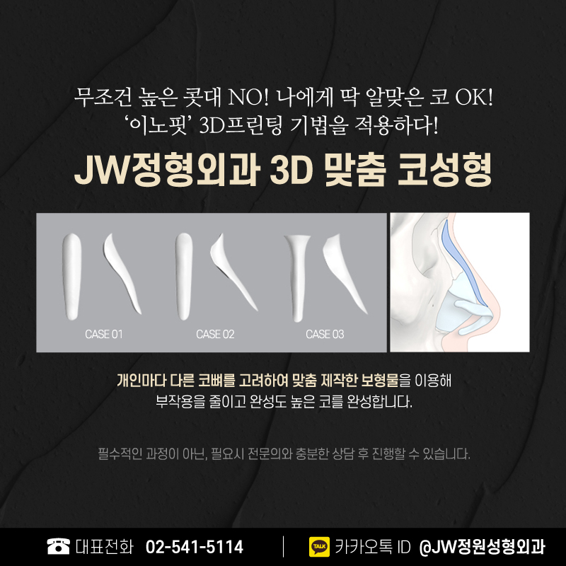 코수술전후 극명한 차이가 느껴진다! 【강남 JW정원성형외과】 관련 이미지 7