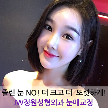 졸린 눈 No! 더 크고 더 또렷하게! JW정원성형외과 눈매교정 관련 이미지 1
