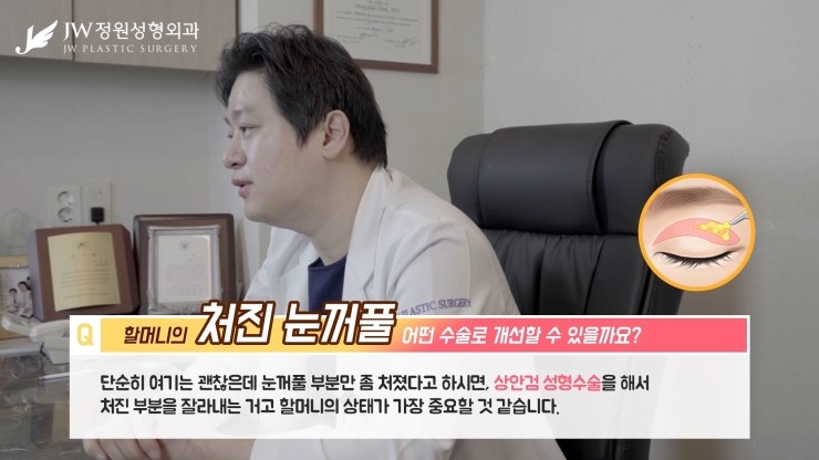 [JW정원성형외과] 할머니의 처진눈꺼풀.. 무슨수술을 해야할까요? 관련 이미지 13