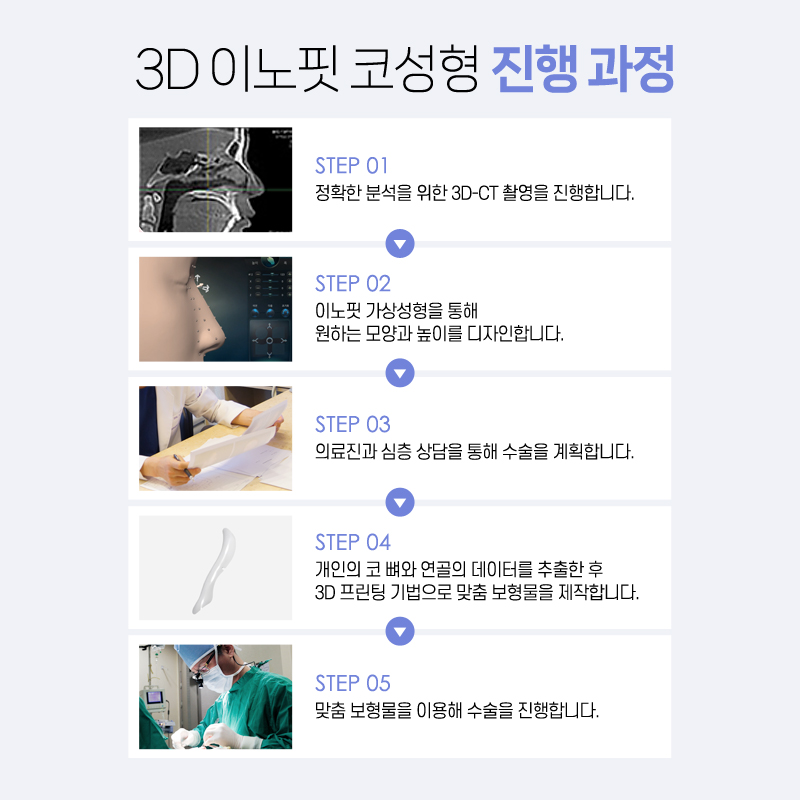 Nose Tip Surgery Review for a More Three-Dimensional Face image 3