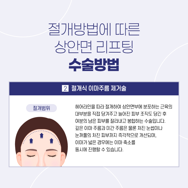 이마거상후기 리프팅으로 쫙 올라간 효과는 관련 이미지 4