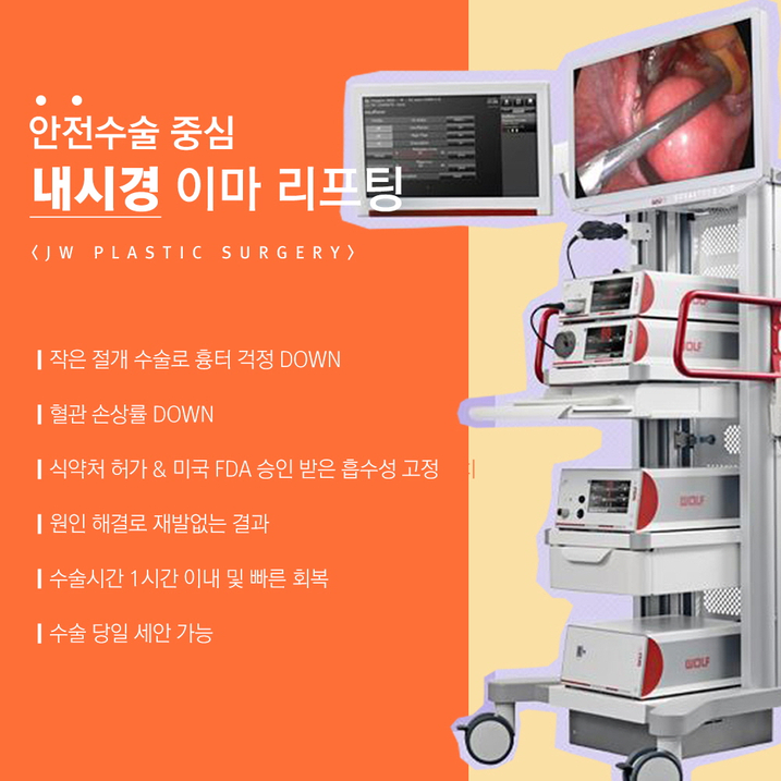 Endoscopic Forehead Lift, Improving a Drooping and Depressed Look to Complete a Youthful Appearance image 4