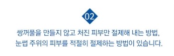 탄력있는 눈매로 확실하게 젊어지는 JW정원성형외과 상안검성형 관련 이미지 4