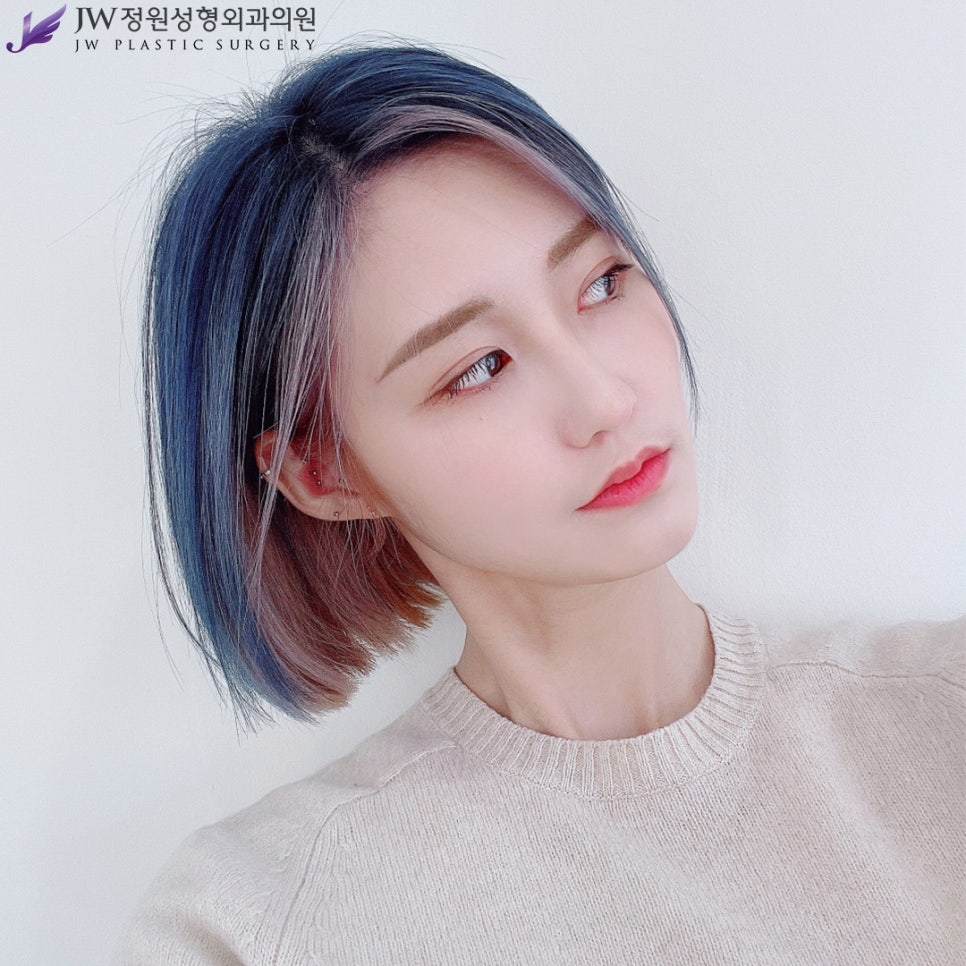 Uncomfortable Epicanthal Folds? If It’s an Epicanthoplasty, You Can Change to a Fresher, Softer Impression image 1