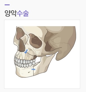 매끈한 얼굴라인과 턱기능 개선을 동시에! JW정원성형외과 주걱턱성형 관련 이미지 4