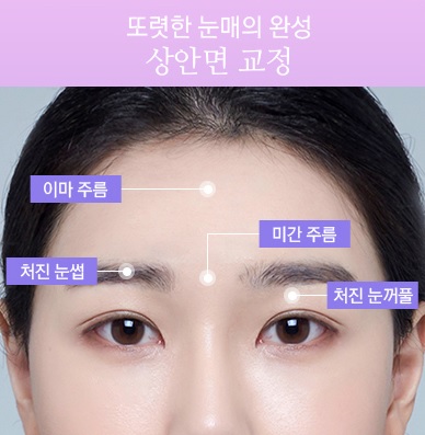 뼈 수술 없이 매끄러운 브이라인얼굴! JW정원성형외과 윤곽교정 관련 이미지 2