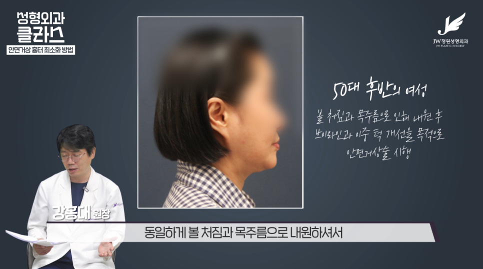 안면거상술후기 흉터 걱정 없이 깔끔하게!  【강남 JW정원성형외과】 관련 이미지 21