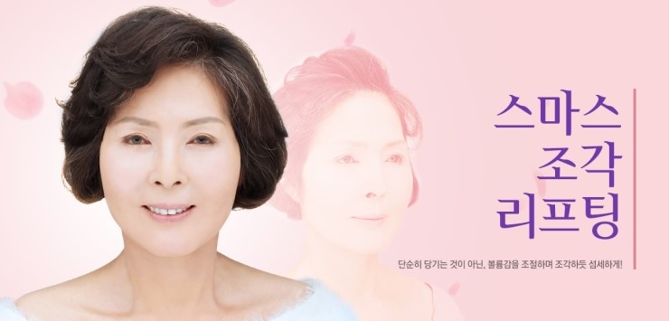 강력한 리프팅 효과로 동안 유지▷▶JW정원성형외과 스마스 조각 리프팅 관련 이미지 1