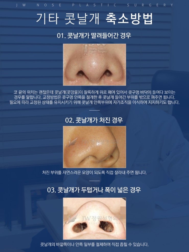 콧대와의 밸런스를 고려한 슬림한 코끝 JW정원성형외과 복코교정 관련 이미지 7