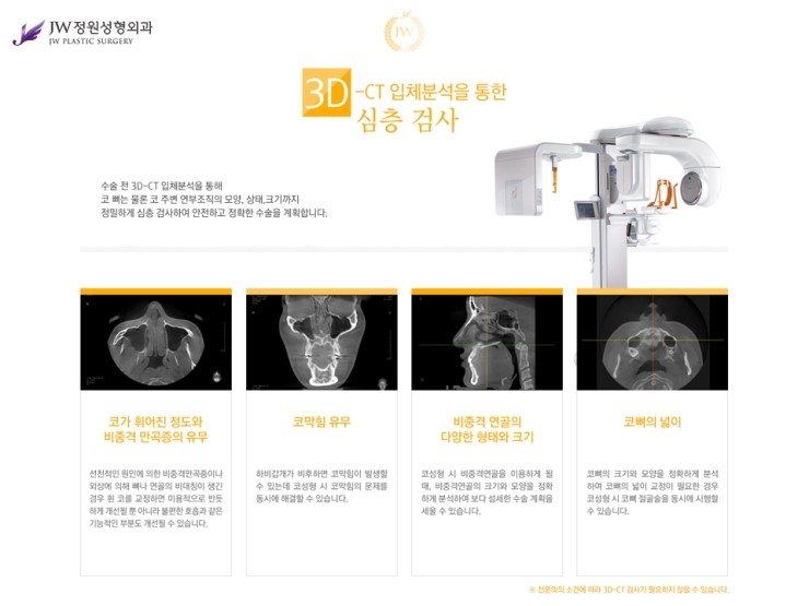 [JW정원성형외과] 코끝성형비용 보다 중요한건 코끝성형결과! 관련 이미지 8
