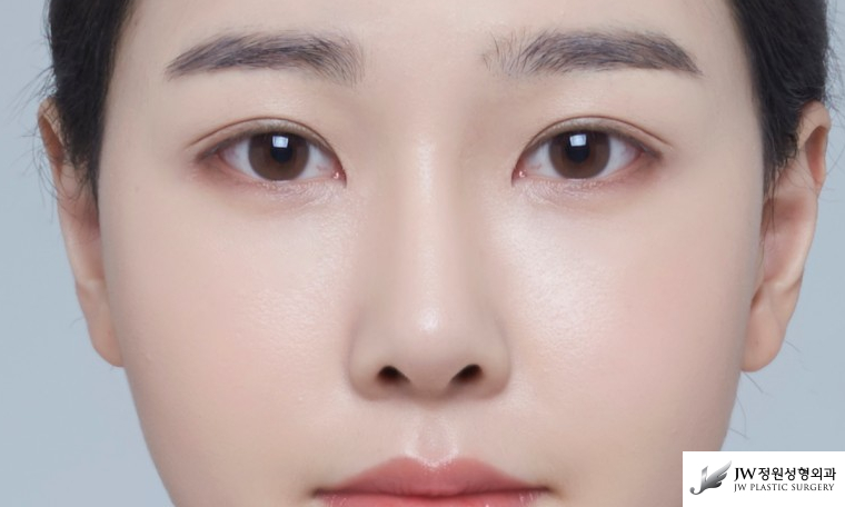 이상적인 코모양의 완성은 비주에서부터, 자가연골로 비주빼기 관련 이미지 2