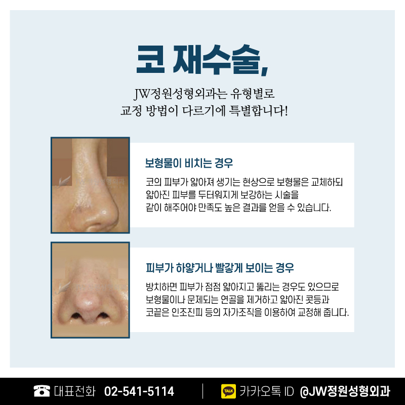 코재수술성형외과 선택의 중요성! 【강남 JW정원성형외과】 관련 이미지 6